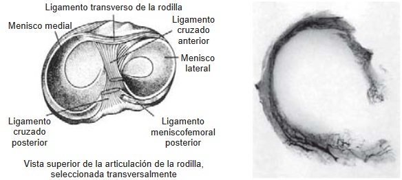 Cirugía de Hombro en Guadalajara | Dr. Esteban Castro - Ortopedia y traumatología | Cirugía articular Lesión de meniscos