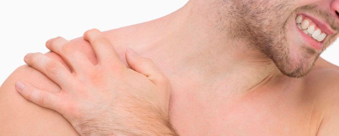dolor en el hombro - ¿Qué es un esguince del hombro?