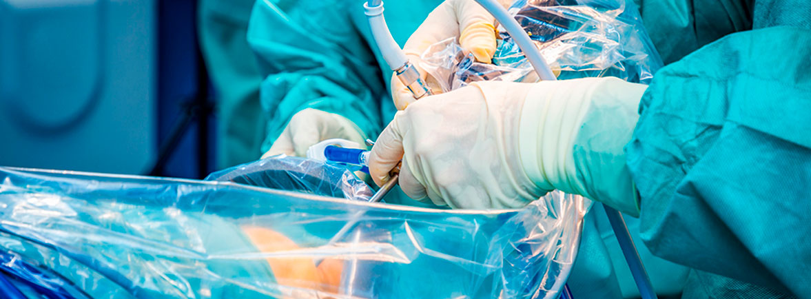Cirugía de Hombro en Guadalajara | Dr. Esteban Castro - Ortopedia y traumatología | Cirugía articular Cirugía artroscópica en Zapopan Cirugía artroscópica en Zapopan