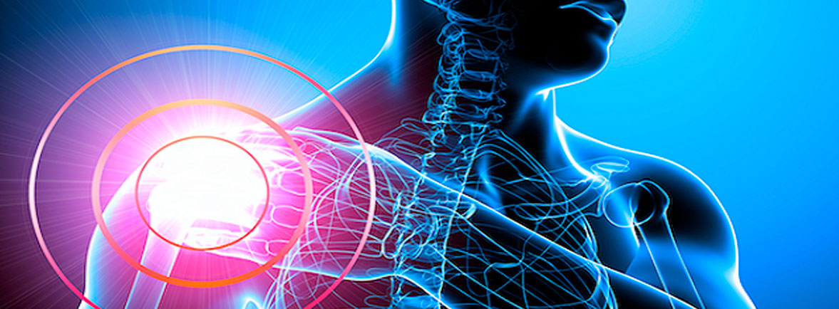 ¿Qué es el Troquiter y Tendinitis?