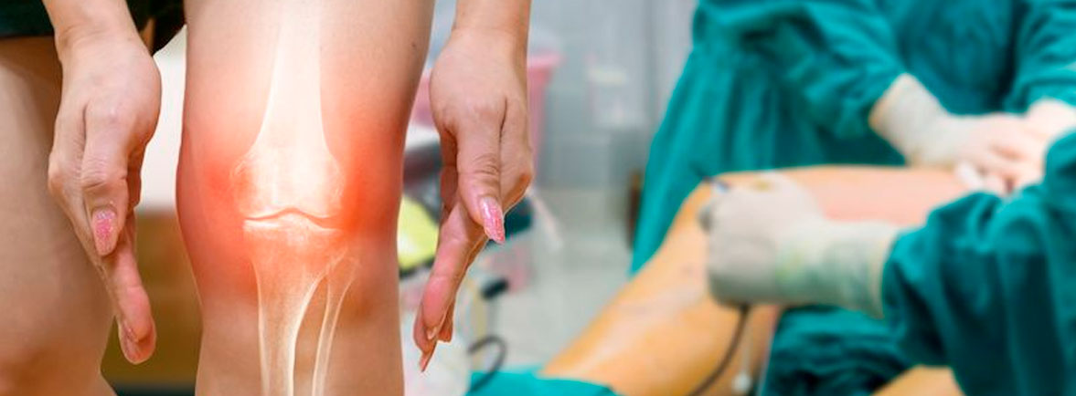 Cirugía de rodilla en Guadalajara