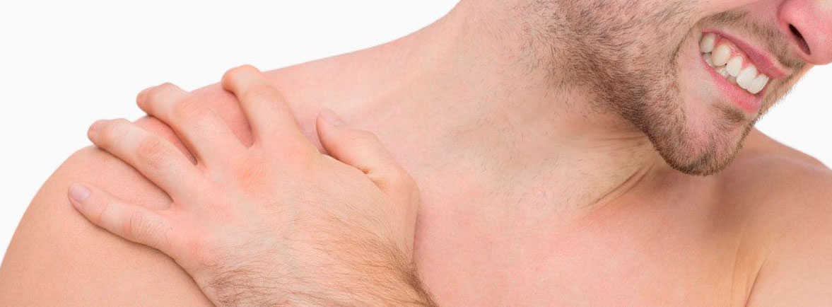 ¿Qué es un esguince del hombro?